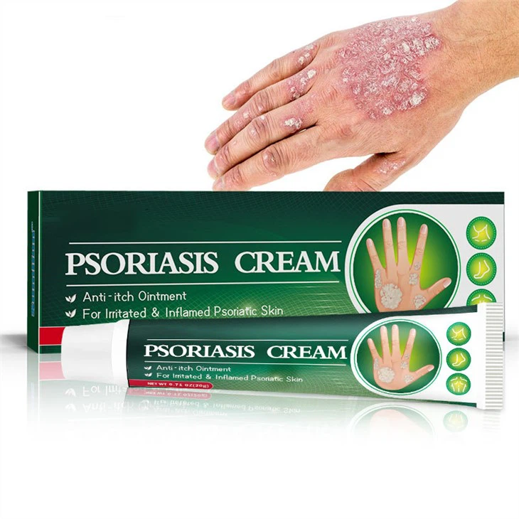Sveppasýkingar Psoriasis krem ​​Húðkrem